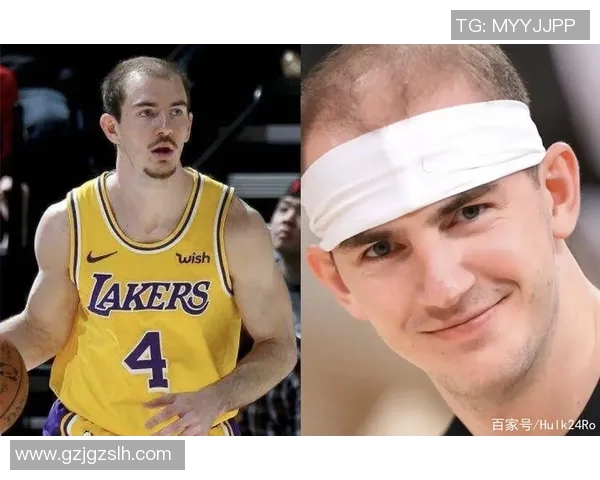 运动明星的秃头困扰：NBA球员亲测发际粉、植发手术与剃光头三大解决方案